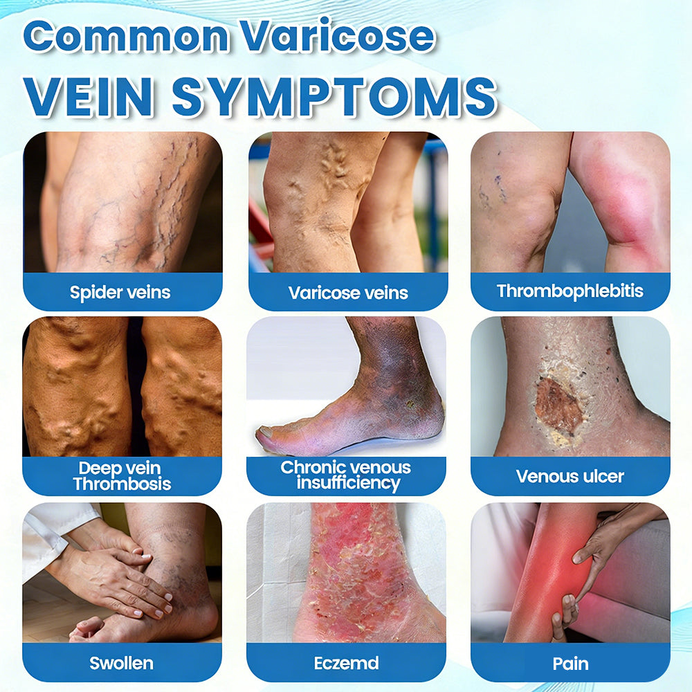 🇺🇸🎁GFOUK® VascuCare Vein Healing Spray(Designed for Varicose veins, Spider veins, Deep vein Thrombosis, Chronic venous insufficiency, Venous ulcers, Thrombophlebitis and other venous issues)