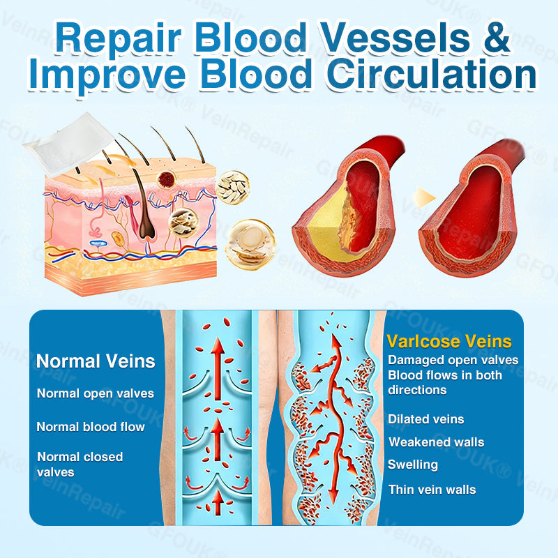 GFOUK® VeinRepair Microneedle Patch Roll⚡Instant Relief, Long-Term Results