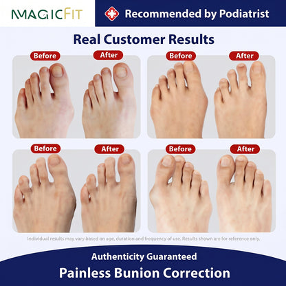 👣Futavion® Bunion Toe Separators for Overlapping Toes Women Men, Gel Toe Spacers Bunion Corrector with 2 Loops for feet, Hammer Toe Straightener