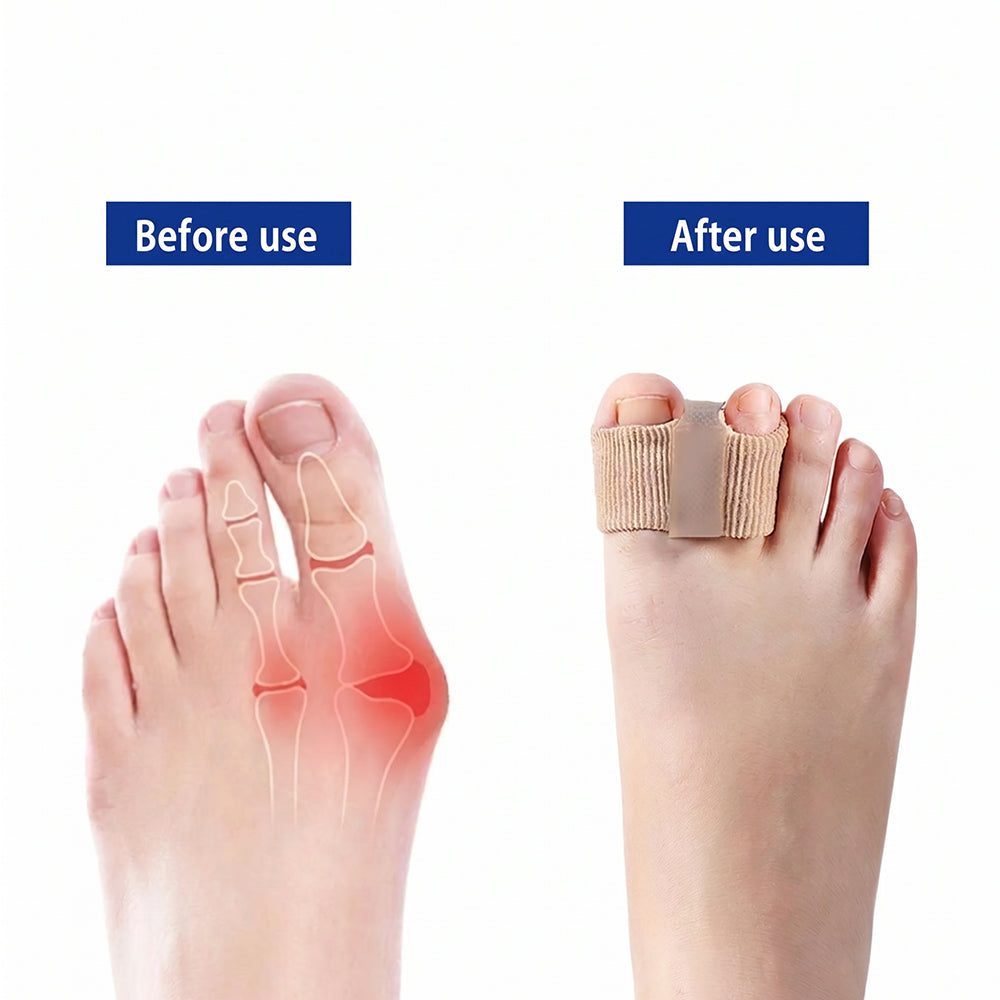 👣Futavion® Bunion Toe Separators for Overlapping Toes Women Men, Gel Toe Spacers Bunion Corrector with 2 Loops for feet, Hammer Toe Straightener
