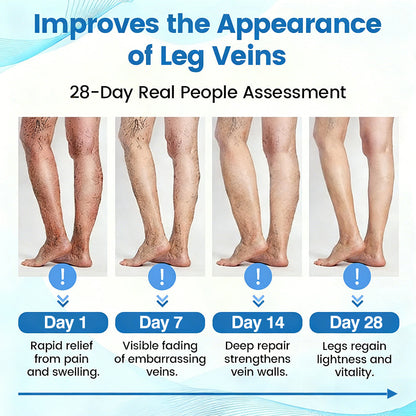 🇺🇸🎁GFOUK® VascuCare Vein Healing Spray(Designed for Varicose veins, Spider veins, Deep vein Thrombosis, Chronic venous insufficiency, Venous ulcers, Thrombophlebitis and other venous issues)