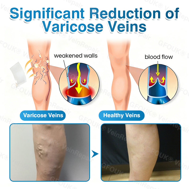 GFOUK® VeinRepair Microneedle Patch Roll⚡Instant Relief, Long-Term Results