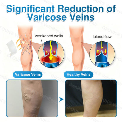 GFOUK® VeinRepair Microneedle Patch Roll⚡Instant Relief, Long-Term Results